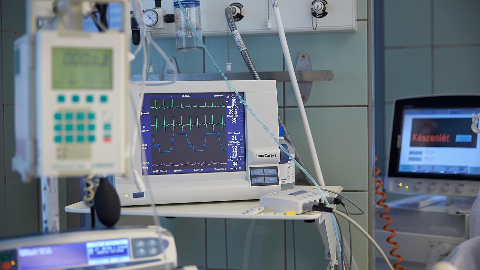 intenziv es aneszteziologia monitor